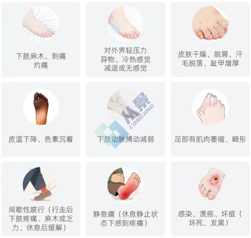 糖尿病足病临床症状
